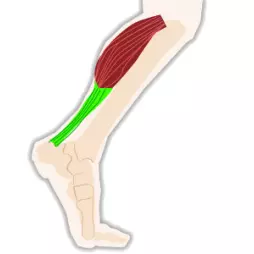 Tendinopatie/Tenditida/Tendinóza/bolesti šlach - bolesti úponů