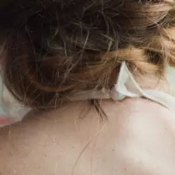 Torticollis – stočení hlavy k jedné straně krku