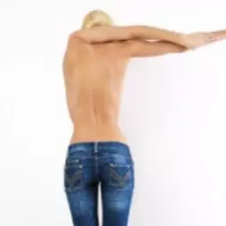 Hypermobilita