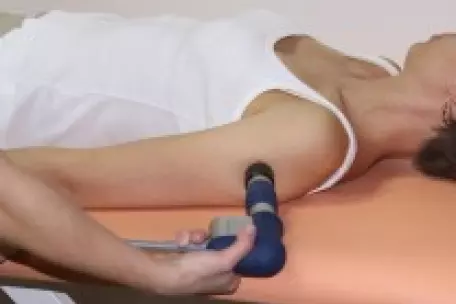 Ošetření paže radiální rázovou vlnou