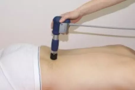 Ošetření bederní oblasti radiální rázovou vlnou