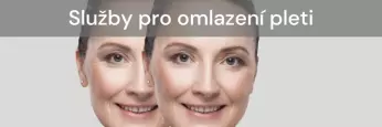 Omlazení pleti