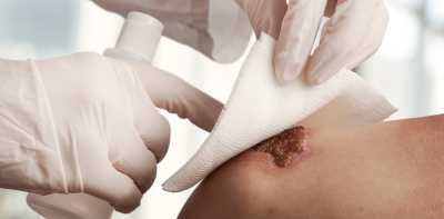 Regenerace a hojení