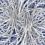 Nervosvalová onemocnění